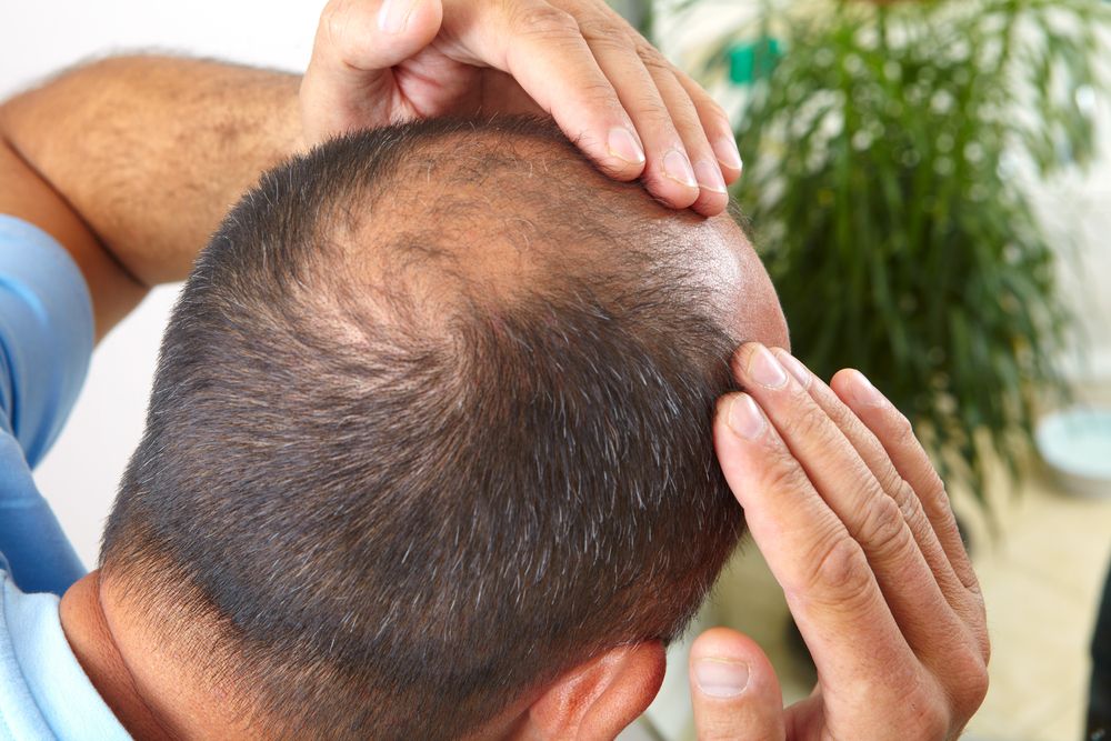 Infection After Hair Transplant